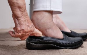 Tips om vochtretentie te voorkomen